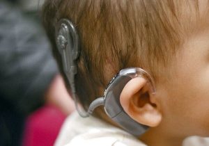 سالانه ۴۰۰ هزار کودک محروم غربالگری رایگان شنوایی میشوند