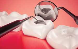 نخستین کنگره ملی دندانپزشکی ترمیمی هوشمند در بابل برگزار میشود