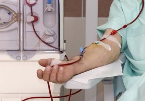 ۱۵۷۲ بیمار دیالیز از علوم پزشکی گیلان خدمات می گیرند