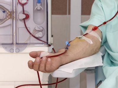 ۱۵۷۲ بیمار دیالیز از علوم پزشکی گیلان خدمات می گیرند